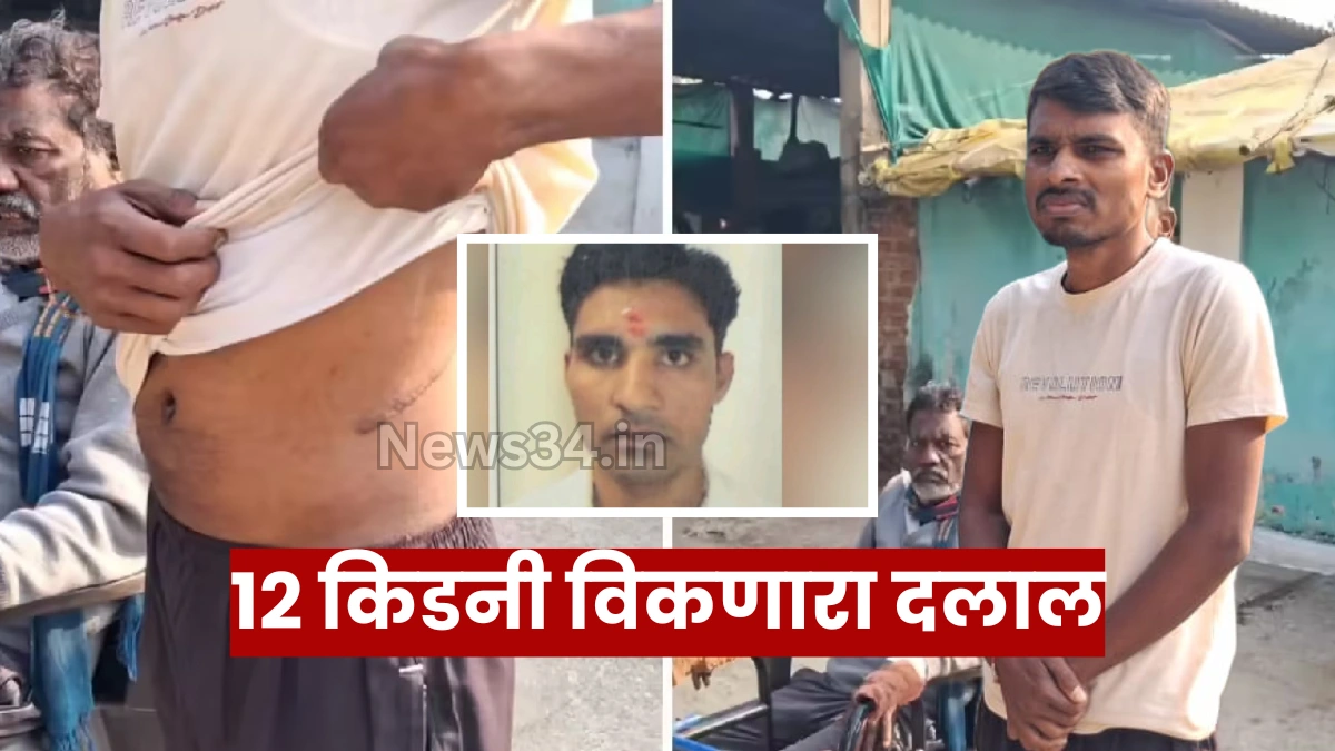 Kidney selling racket